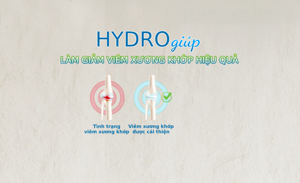 Uống nước và hít khí giàu Hydro giúp làm giảm viêm xương khớp