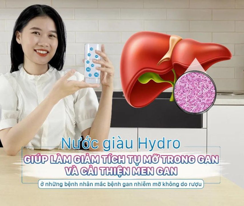 Nước giàu Hydro giúp làm giảm tích tụ mỡ trong gan và cải thiện men gan ở những bệnh nhân mắc bệnh gan nhiễm mỡ không do rượu